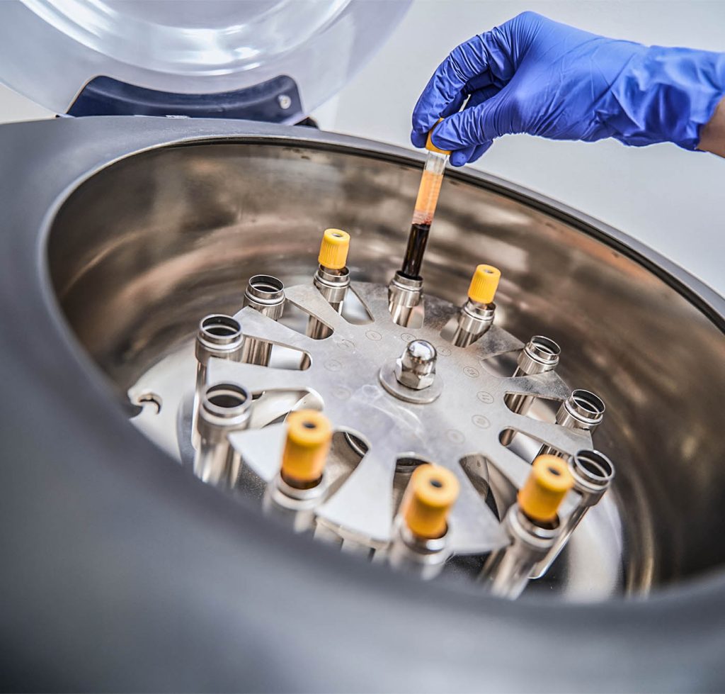 Amostra de Sangue em uma Centrífuga