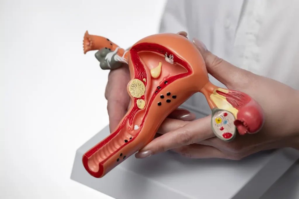 Mulher segurando um útero de plástico com base branca, em fundo branco, utilizado como equipamento de estudo.