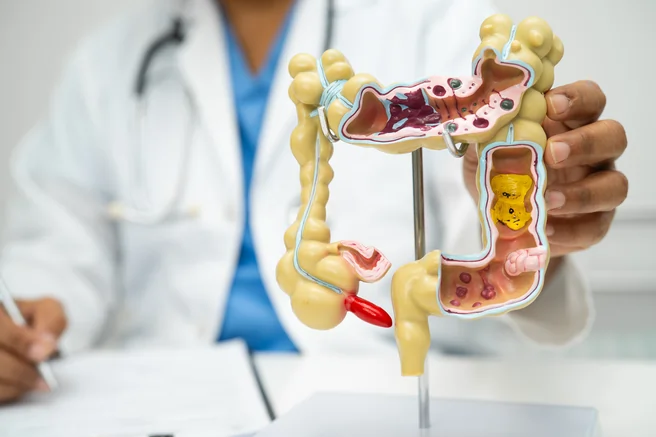 Modelo do sistema digestivo